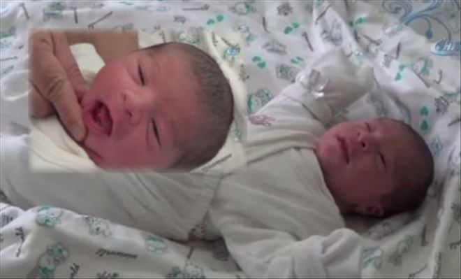Dişleri Çıkmış Bebe dünyaya geldi 