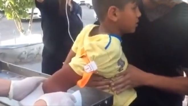 Elini Kıyma Makinesına Kaptıran Çocuğun Parmakları Koptu