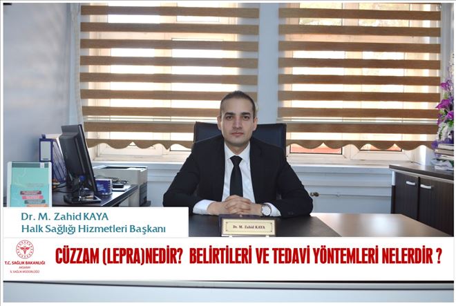          Cüzzam (lepra)nedir?  Belirtileri ve tedavi yöntemleri nelerdir ?